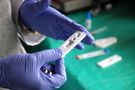 Największe mity na temat HIV - obalają eksperci