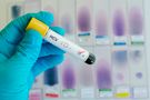 HCV - jestem świadom. Kampania przeciw wirusowi powodującemu WZW typu C