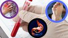 Grupa krwi ma wpływ na wystąpienie poważnych chorób! Sprawdź, na co możesz zachorować