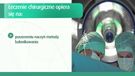 Niedokrwienie kończyn dolnych: leczenie