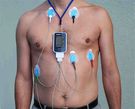 Monitor holterowski EKG