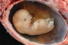 Aborcja - zdjęcia