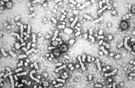 HBV - obraz mikroskopowy
