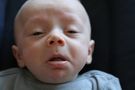 Alergia u niemowlaka