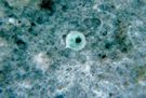 Entamoeba histolytica - zdjęcia