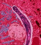 Sporozoit