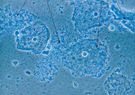 Bakterie beztlenowe wywołujące zapalenie pochwy (Gardnerella vaginalis)