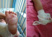 2-letnia Maja poparzyła się w parku miejskim. Matka winą obarcza właściciela obiektu