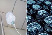 Wstrzymanie w obrocie serii leku. Prawdopodobnie zawiera priony, które wywołują zwyrodnienie mózgu