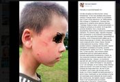 Chłopiec z domu dziecka uderzony przez opiekunkę. To nie był pierwszy raz?