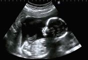 Ważne jest prawo wyboru. Ważny głos blogerki w sprawie aborcji