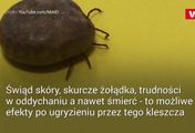 W tych miejscach może ugryźć cię kleszcz. Warto je sprawdzać