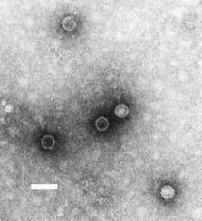 Wirus Polio