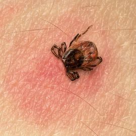 Ważny Temat - Kleszczowe Zapalenie Mózgu. Poznaj fakty. Zapobiegaj!
