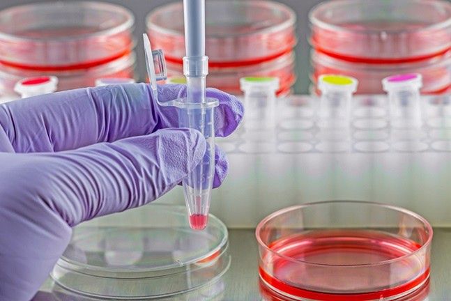Badania pozwolily prześledzić historię wirusa HIV