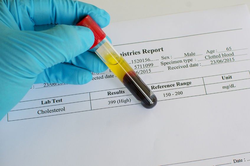 Wysoki poziom cholesterolu to czynnik ryzyka wielu chorób