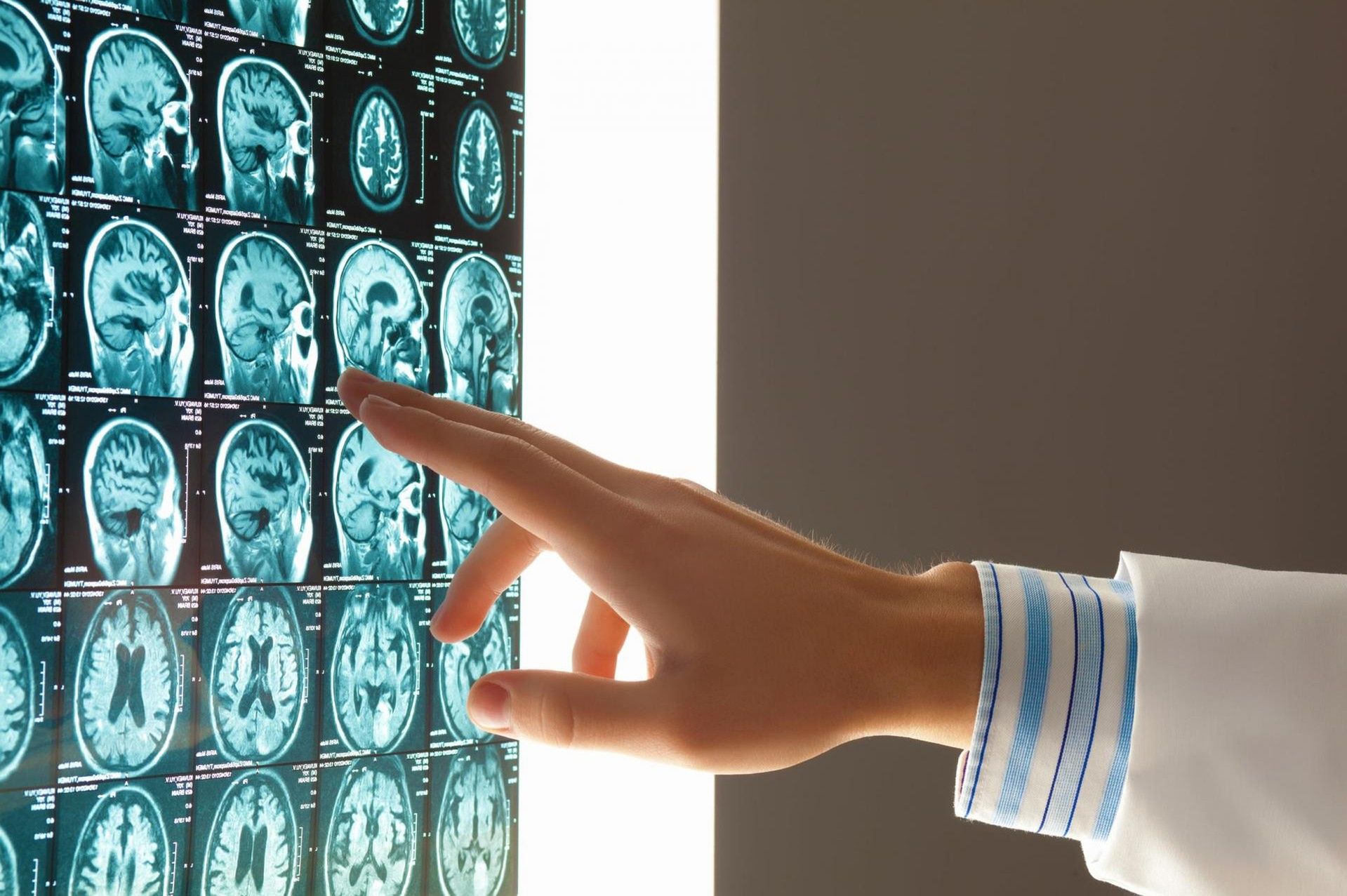 Obrzęk mózgu wymaga natychmiastowej diagnozy i specjalistycznego leczenia