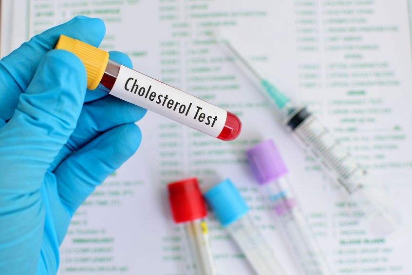 Badania nad cholesterolem wykazały, że ma on również duży wpływ na zdrowie mózgu