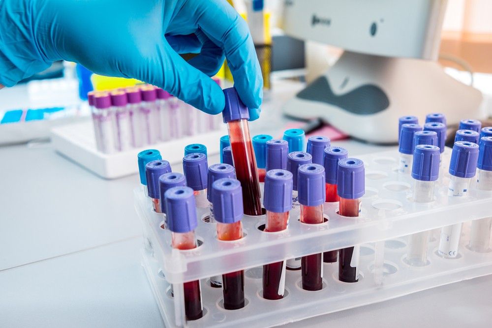 Badanie poziomu TSH jest podstawowym badaniem diagnostycznym chorób tarczycy