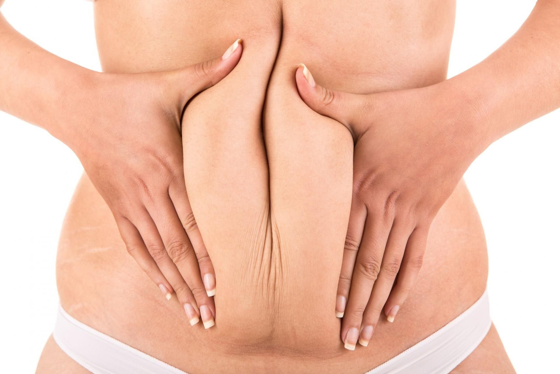 Obwysłą skóra na brzuchu, to cecha charakteryzująca osoby określane mianem skinny fat