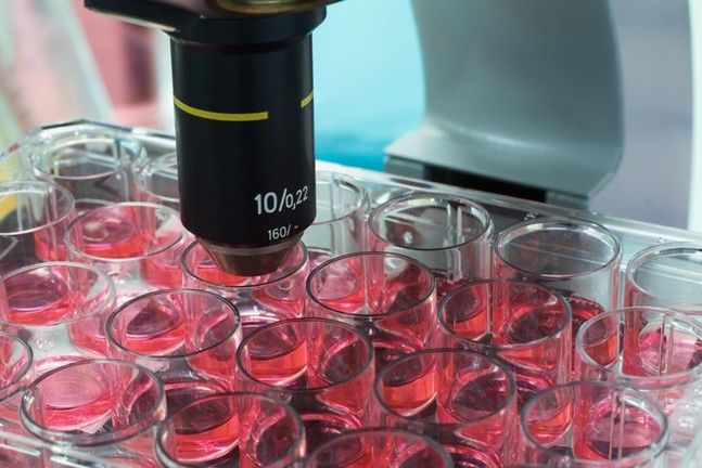 Cytologię wykonywac możemy na kilka sposobów, a wyniki cytologii dadzą nam ważne informacje