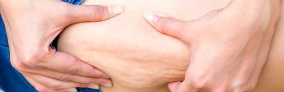 Przedstawiamy najpopularniejsze zabiegi na cellulit - przekonaj się, które z nich są skuteczne