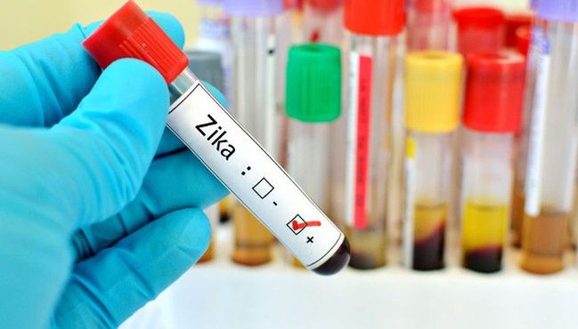 Trwają badania nad działaniem wirusa Zika
