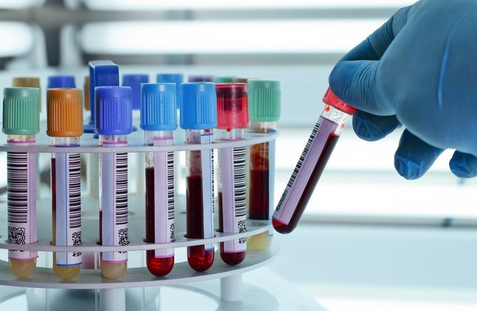 Nowa metoda diagnostyki szpiku kostnego