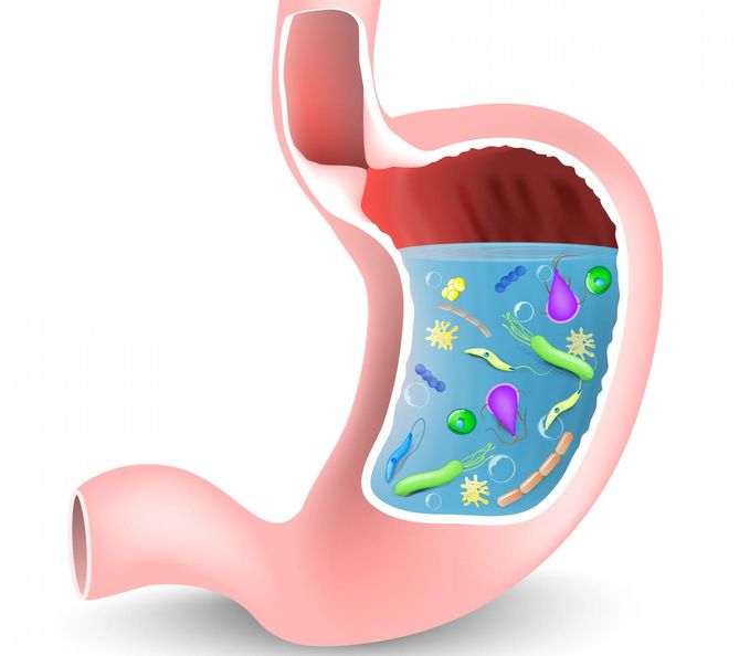 Ból z lewej strony pod żebrami często powodowany jest przez zakażenia Helicobacter Pylori