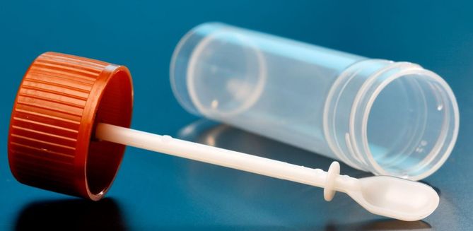 Śluz w kale wymaga specjalistycznych badań laboratoryjnych