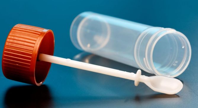 Przewlekłe rozwolnienie wymaga przeprowadzenia analizy kału