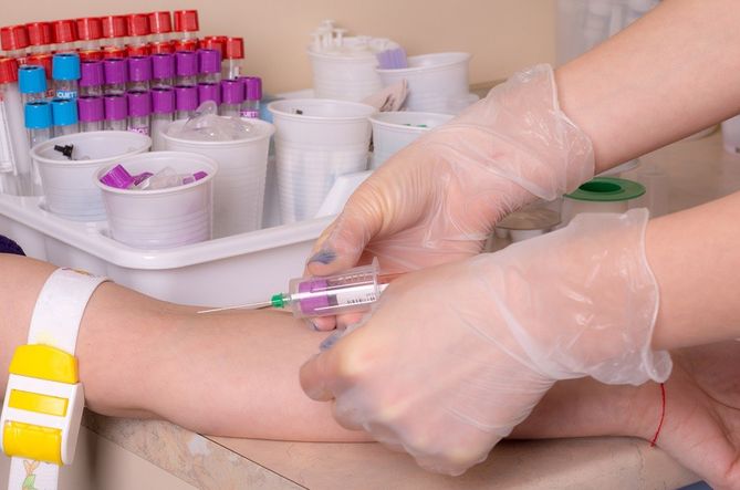Poziom tyreotropiny określa się poprzez badanie krwi.