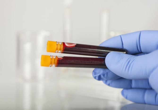 Biochemia krwi pozwala na ocenę funkcjonowania organizmu