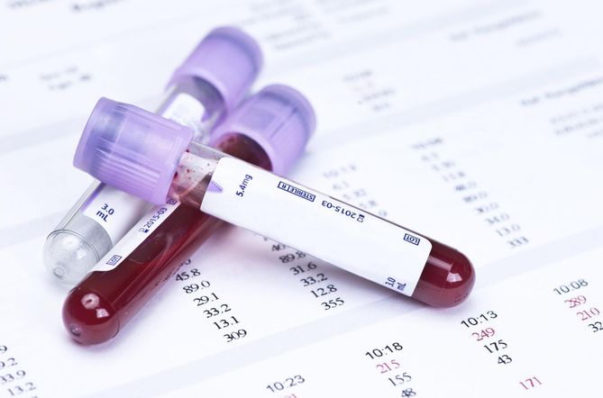 Listerię monocytogens można wykryć dzięki badaniu krwi.