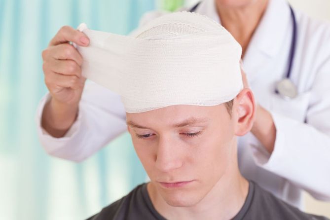 Naukowcy zbadali wpływ wstrząsu mózgu na ryzyko wystąpienia choroby Alzheimera