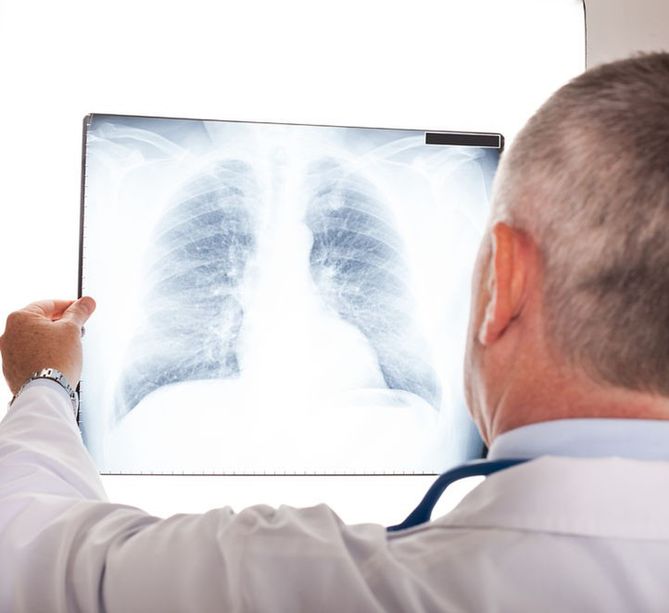 Mykoplazma pneumoniae powoduje atypowe zapalenie płuc