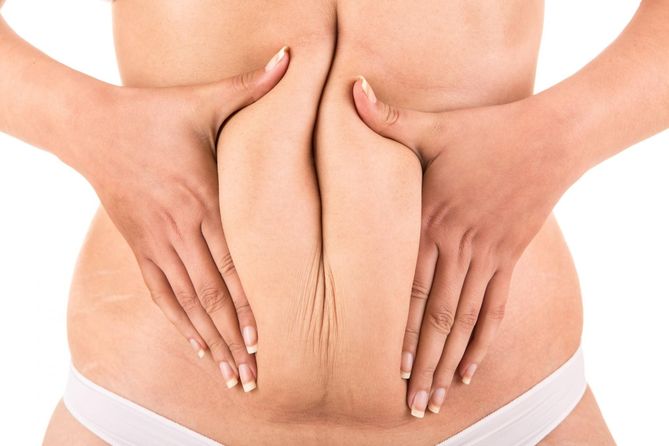 Obwysłą skóra na brzuchu, to cecha charakteryzująca osoby określane mianem skinny fat