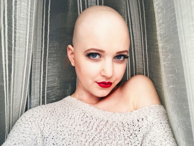 Claudia Kowalewska przed chorobą była fotomodelką