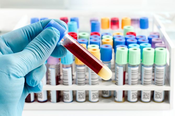 W diagnostyce tocznia bardzo pomocne są badania laboratoryjne