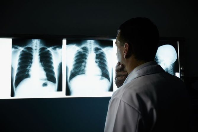 Tomografia komputerowa ma duże znaczenie w diagnostyce nowotworów kości