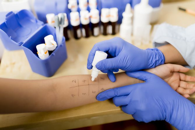 Leczenie alergii jest bardzo trudne i czasochłonne. Najłatwiejszym sposobem na określenie właściwej drogi leczenia jest wykonywanie testów alergicznych