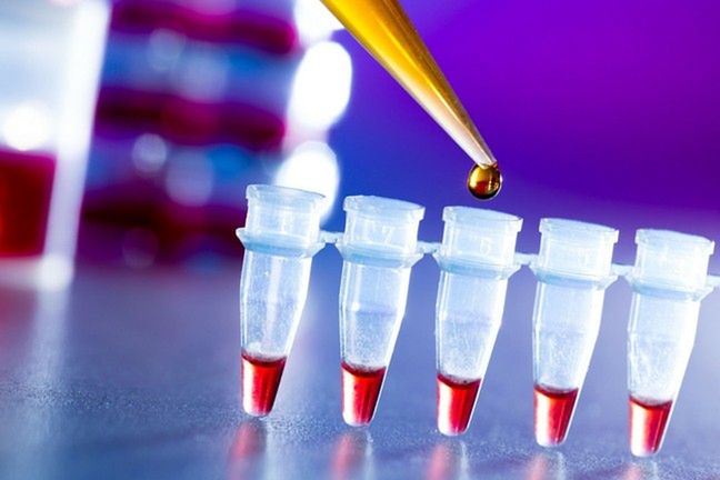 123RF: Test na HIV