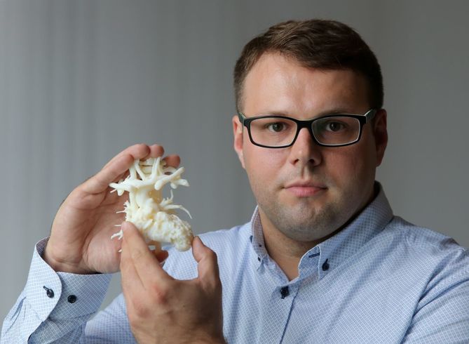 Wojciech Wojtkowski opracował serce 3D by ratować własnego syna.