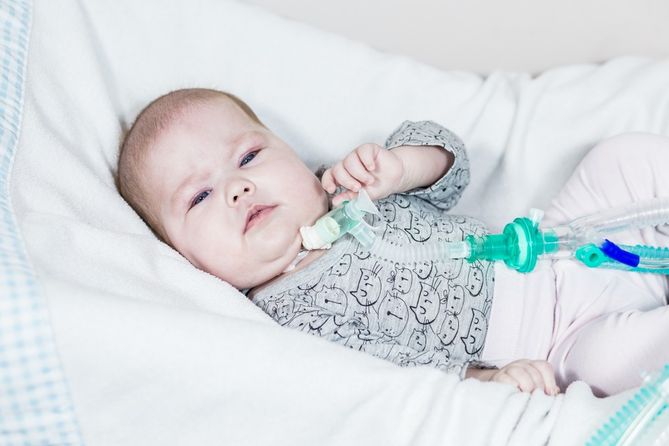 U Banki zdiagnozowano klątwę Ondyny