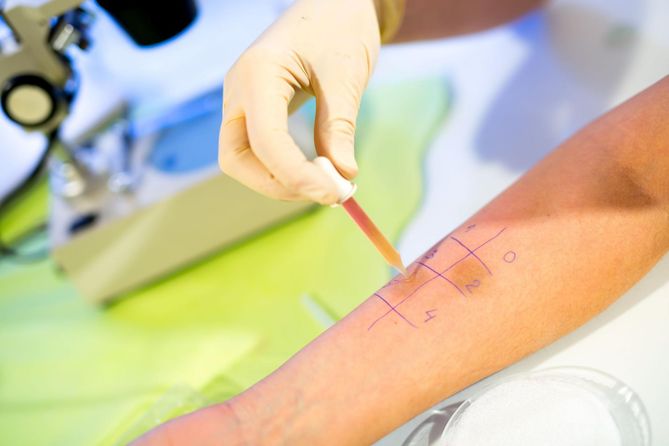 Aby zdiagnozować alergię, wykonuje się specjalne testy