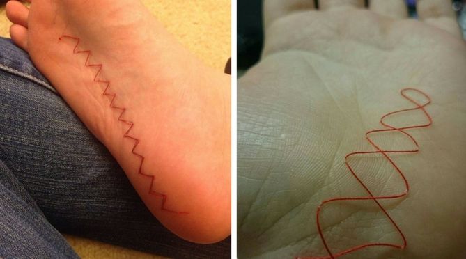 Skin stitching - nowe wyzwanie wśród nastolatków