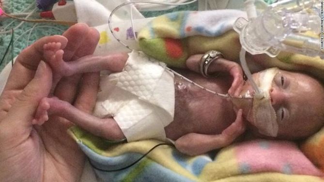 (Courtney Stensrud) Zdjęcie wykonane w 3 tygodnie po narodzinach dziewczynki
