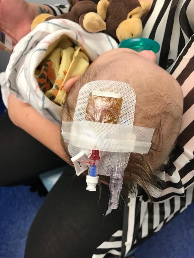 Siedmiotygodniowa siostrzenica Alecii poważnie zachorowała