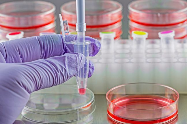 Badania pozwolily prześledzić historię wirusa HIV