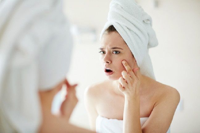 Osoby, które miały problem z trądzikiem, dłużej będą cieszyć się młodą skórą